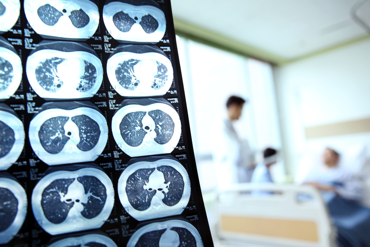 (무)KB 닥터실속건강보험Ⅱ(해약환급금미지급형)(24.05)(암플랜)